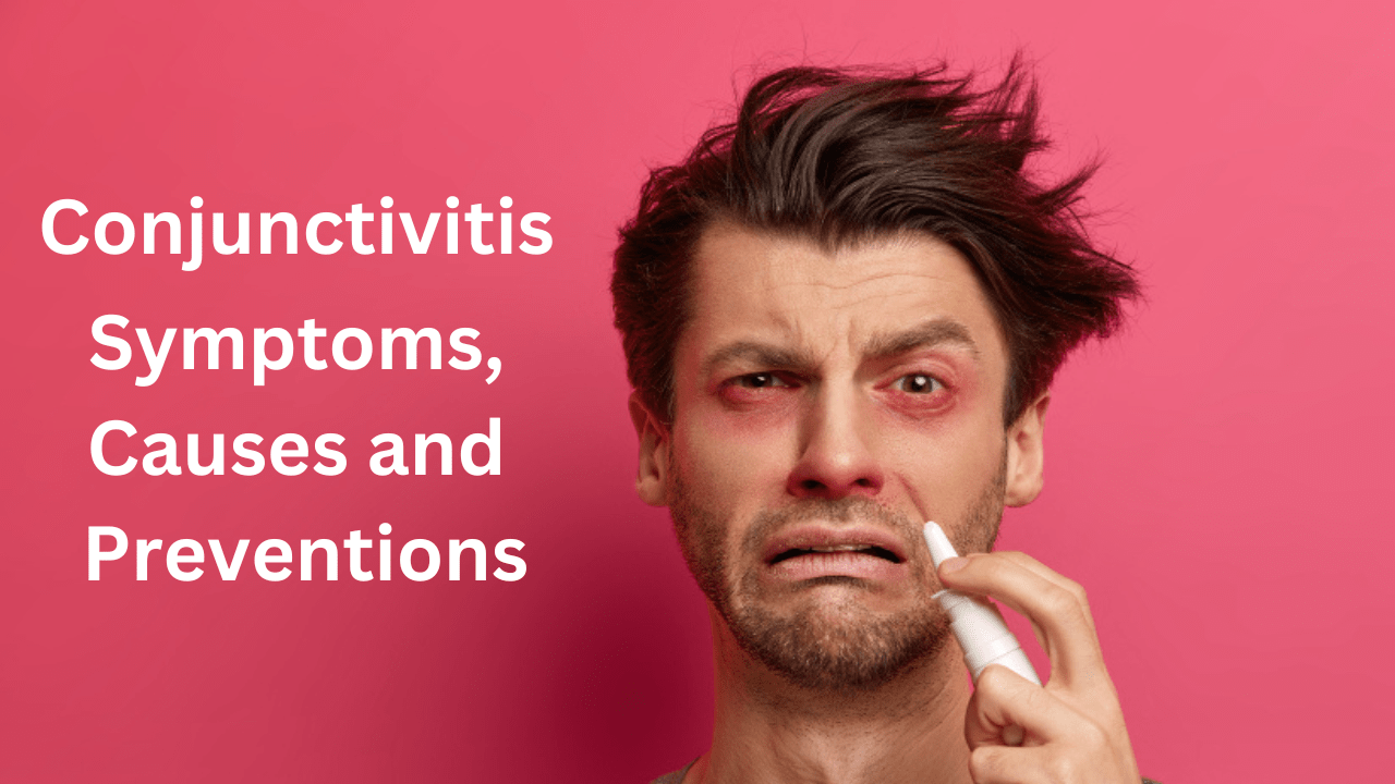 Conjunctivitis Symptoms, Causes and Preventions